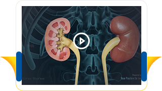 Patient Education & Resources